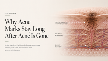 Why Acne Marks Stay Long After Acne Is Gone