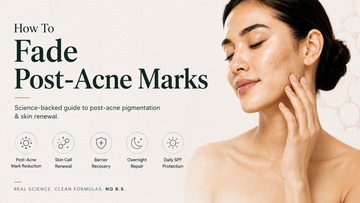 Fade Post Acne Marks Naturally