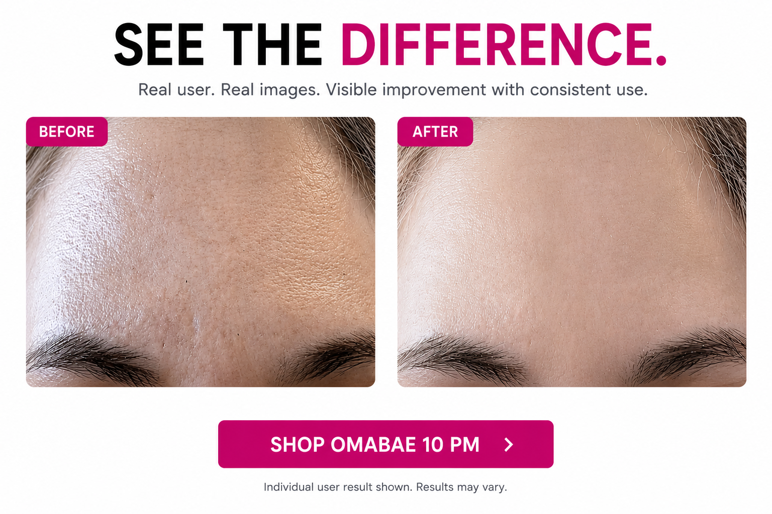 slider image slider_item_FrmQgF